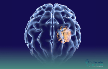 Neurocirurgia Oncológica: Muito Além da Cirurgia
