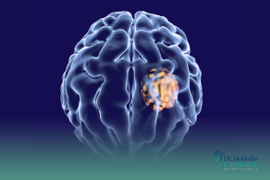 Neurocirurgia Oncológica: Muito Além da Cirurgia